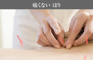 はり